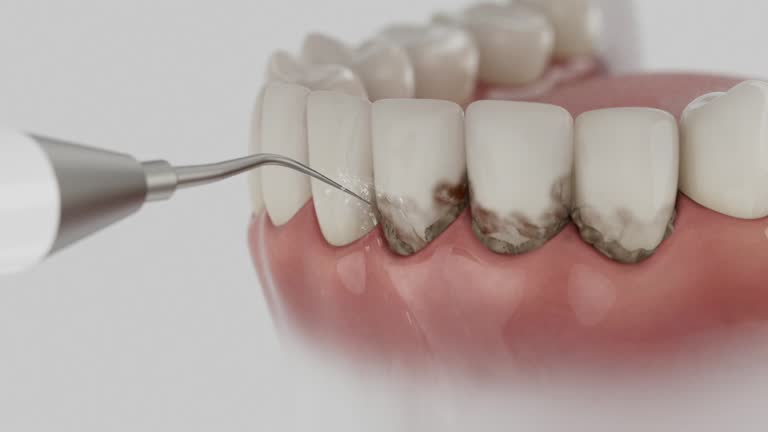 Trusted Dental Implants service in Good Hope, CA - Dentist Open Now